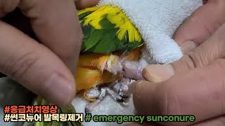 썬코뉴어발목링제거 [cutting birdring]