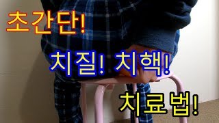 치질 치핵 초간단 치료법 ! hemorrhoids treatment ! 쑥카이