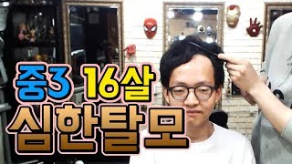 [탈모] 중3인데 벌써 머리가 다 빠졌네요.. 예쁘게 …